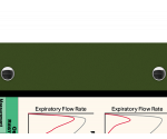 WhiteCoat Clipboard® Trifold - Army Green Respiratory Therapy Edition